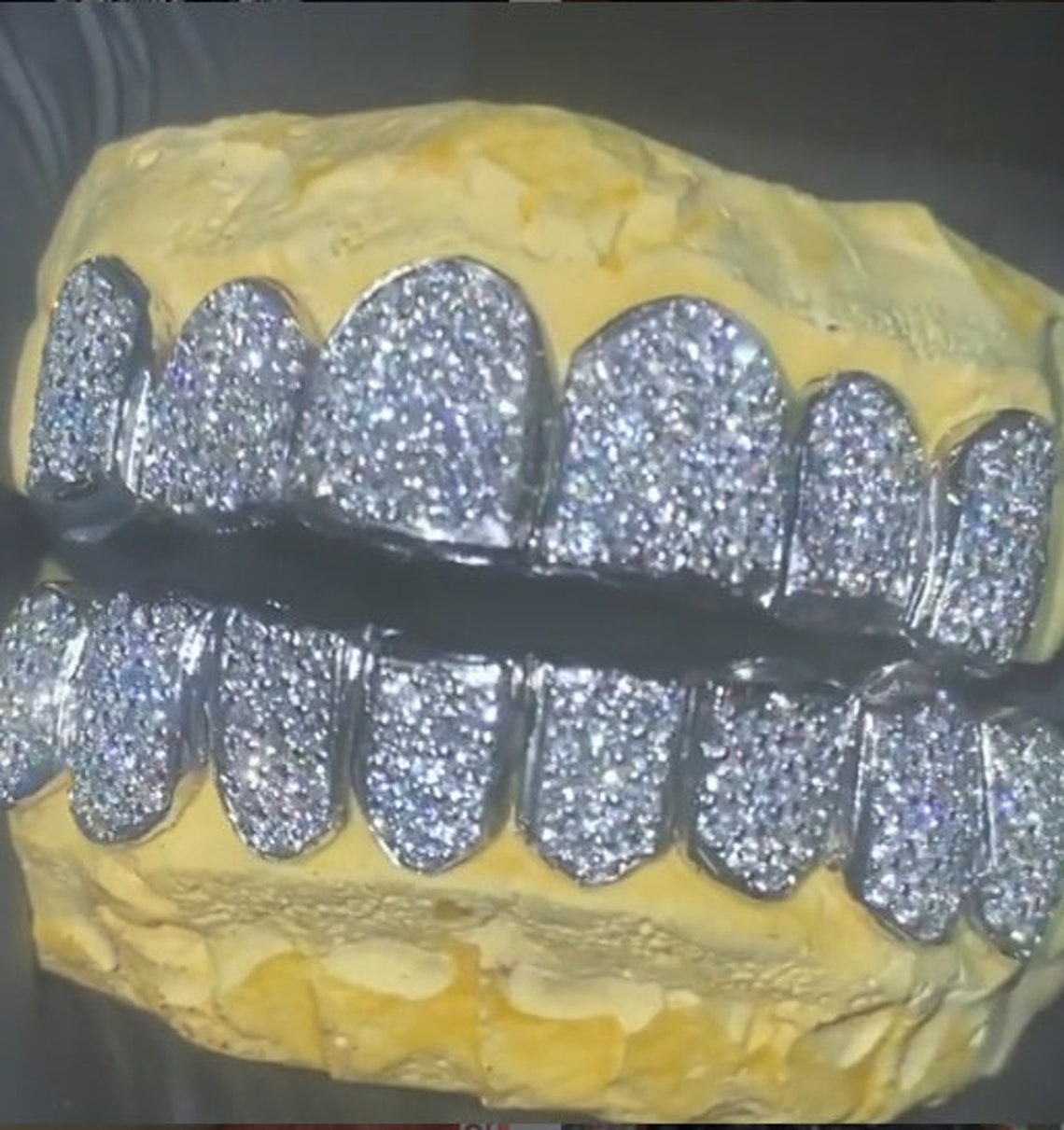 925 Sterling Silver Custom Teeth Grillz 14k Whitegold 8 Top 8 Etsy