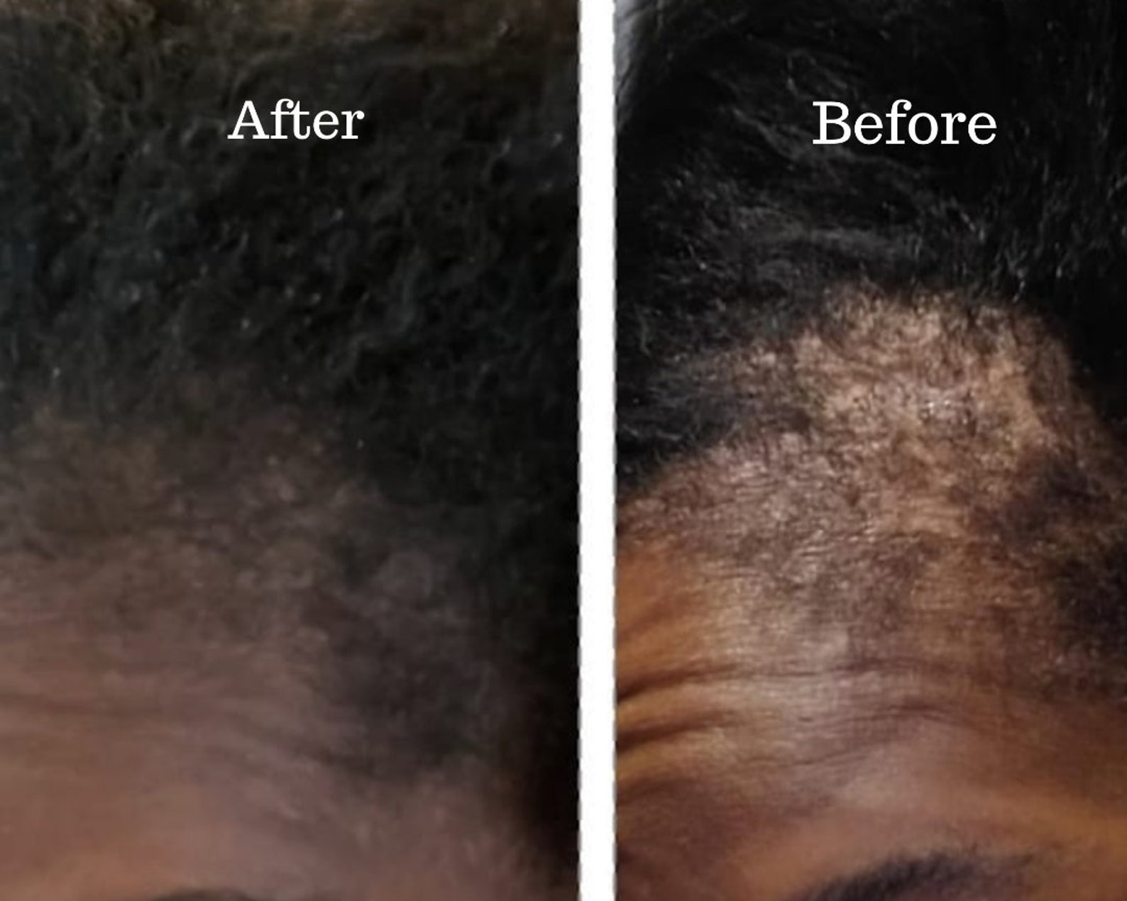 Miracle Rice Oil for extreme hair growth FAST | Etsy