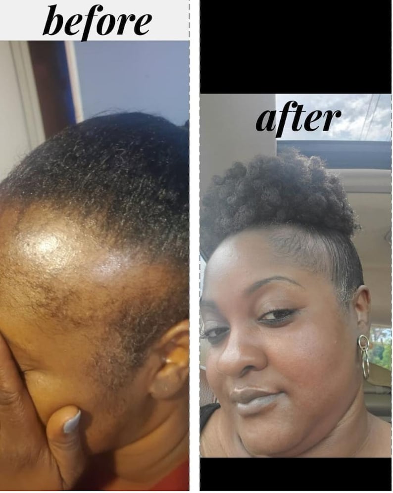 Miracle Rice Oil for Extreme Hair Growth FAST Etsy