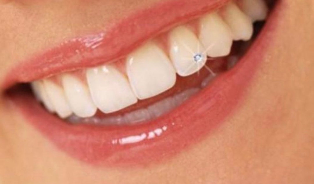 Inspired by Louis Vuitton (LV) – Swarovski Tooth Crystals & Tooth