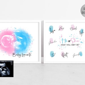 Benutzerdefinierte Baby Ultraschall Art Print digitales Aquarell Schwangerschaft Geschenk Sonogramm druckbare Geschlecht offenbaren Baby-Dusche-Geschenk Er oder sie Ratespiel