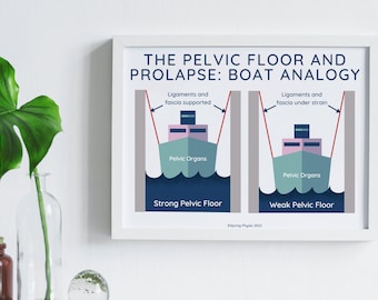 Póster de fisioterapia del suelo pélvico / Suelo pélvico y prolapso / Fisioterapia del suelo pélvico