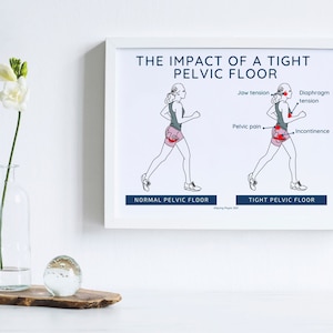Physical Therapy Pelvic Floor | Hypertonic Pelvic Floor | Pelvic art | Pelvic Poster