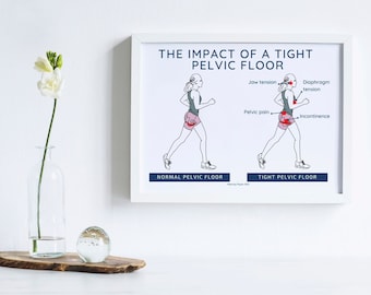 Physical Therapy Pelvic Floor | Hypertonic Pelvic Floor | Pelvic art | Pelvic Poster