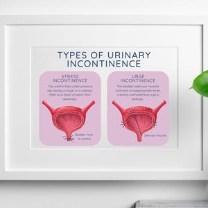 Plakat edukacyjny na temat nietrzymania moczu | Sztuka dna miednicy (pobranie cyfrowe)