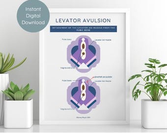 Pelvic Floor Anatomy Print | Levator Avulsion Art (Digital Download)