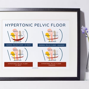 Pelvic Floor Physical Therapist Poster | Hypertonic Pelvic Floor| Pelvic Floor Physical Therapy gift | Pelvis Poster