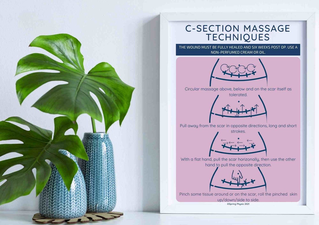 Physical Therapy Massage Scar Massage Art Pelvic Floor Etsy