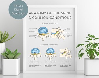 Spine Anatomy and Spinal Conditions | Digital Download PDF