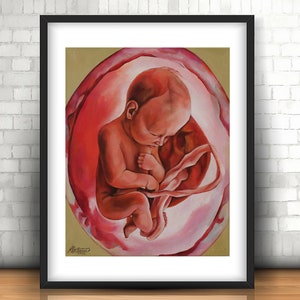 Gemälde Baby-Embryo im Mutterleib - Schwangerschaft, werdende Mutter, Hebamme, Doula, Gyno, OBGYN - Fine Art Print / Leinwand Wandkunst Geschenk