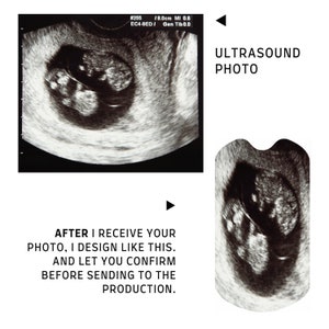 Pu&ograve; includere: Immagine ecografica in bianco e nero di gemelli nel grembo materno. L'immagine &egrave; etichettata "#255 18.0cm MI 0.6 EC4-9ED/ Gen Tlb0.0" e "ULTRASOUND PHOTO".