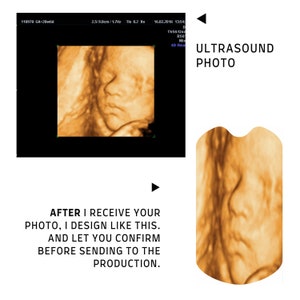 Pu&ograve; includere: Un'immagine di ecografia 3D del viso di un bambino. L'immagine &egrave; in una cornice quadrata con il testo "ULTRASOUND PHOTO" sopra. Il testo "AFTER I RECEIVE YOUR PHOTO, I DESIGN LIKE THIS. AND LET YOU CONFIRM BEFORE SENDING TO THE PRODUCTION." &egrave; sotto l'immagine.
