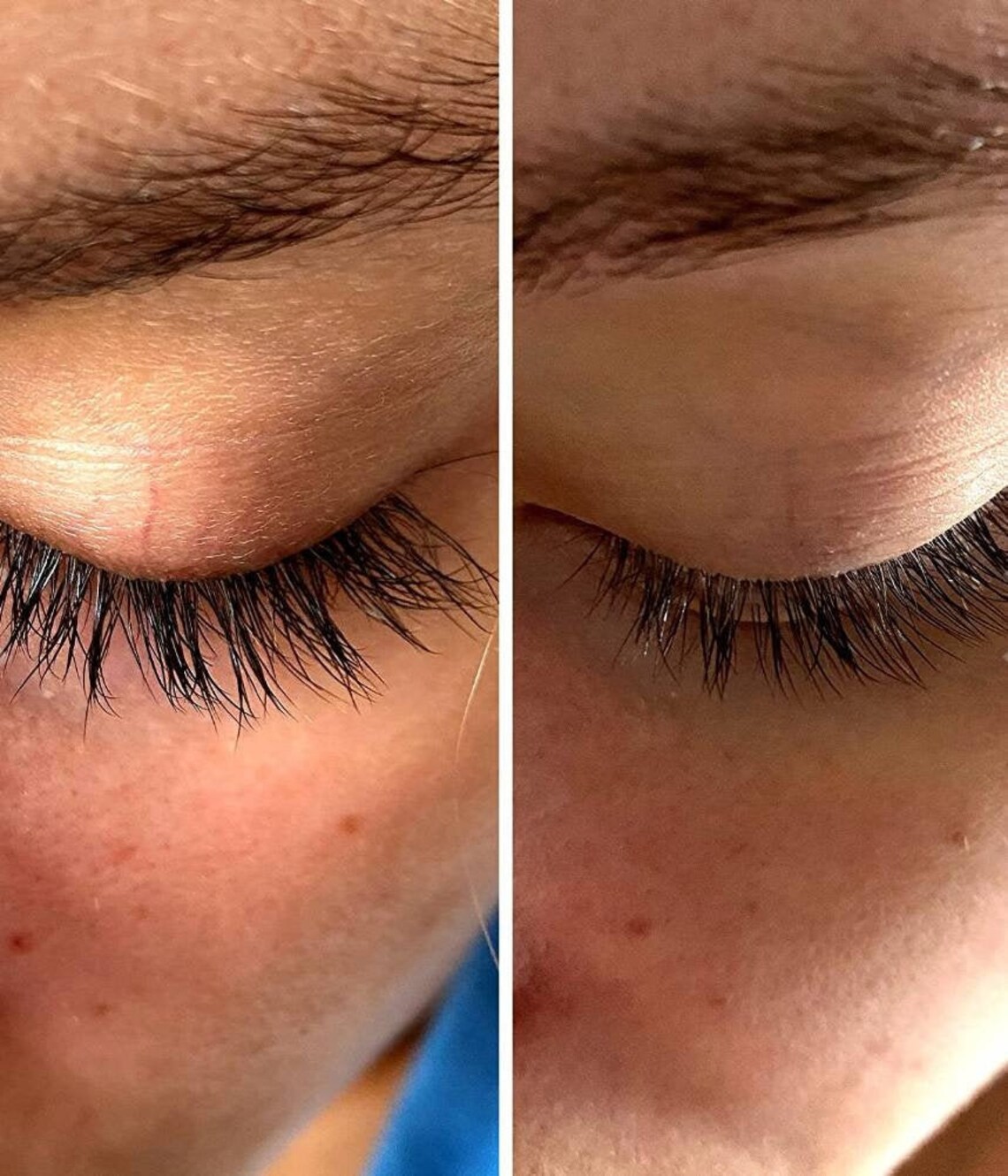 Eyelash Serum Healthy Long Eyelashes Long Eyelashes Argan Etsy