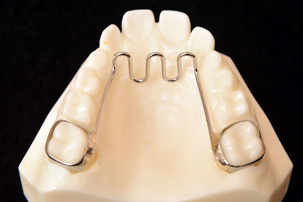 Tongue Crib Appliance Etsy