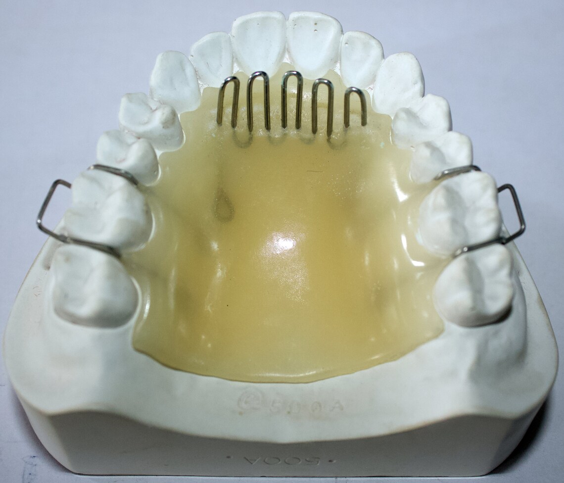 Tongue Crib Appliance Etsy