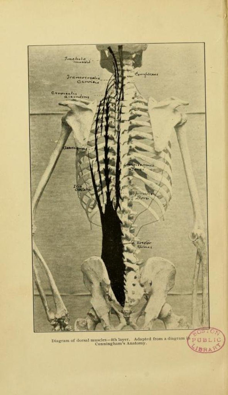 May include: Diagram of the dorsal muscles of the back, showing the different layers of muscles. The diagram is adapted from a diagram in Cunningham's Anatomy.