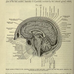May include: A detailed anatomical illustration of the human brain, showing the corpus callosum, the pineal body, the superior colliculi, and the velum interpositum. The illustration is labeled with anatomical terms and includes a key to the different parts of the brain.
