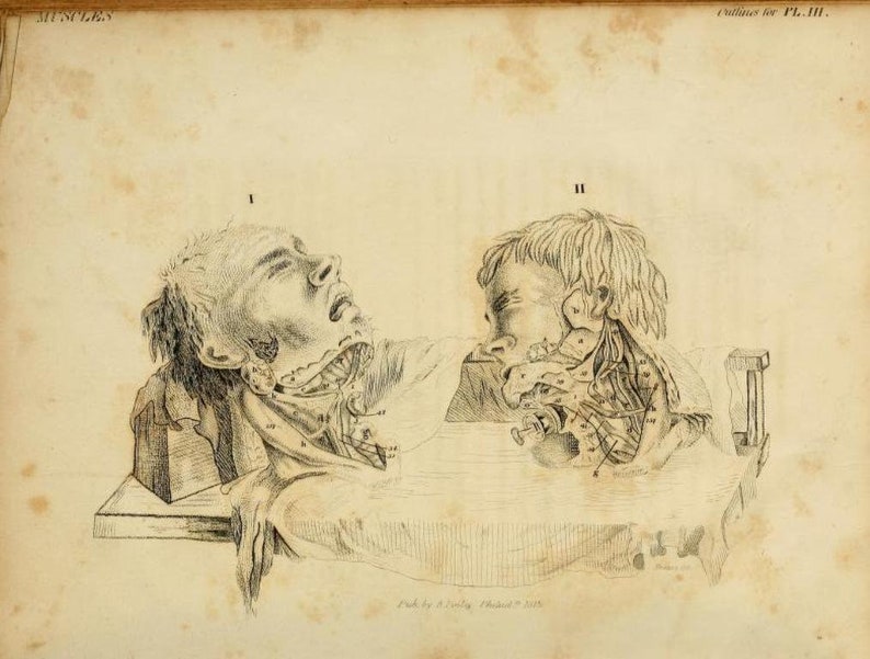 May include: A black and white anatomical illustration of the muscles of the head and neck. The illustration shows two views of the head, one from the front and one from the side. The muscles are labeled with numbers.