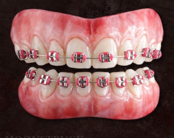 Natural Fake Braces - Random color / Geek / Nerdy / Ugly Betty / Moonstruck effects