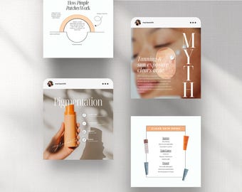 Acne Instagram Templates: Esthetician Social Media Content (Canva)