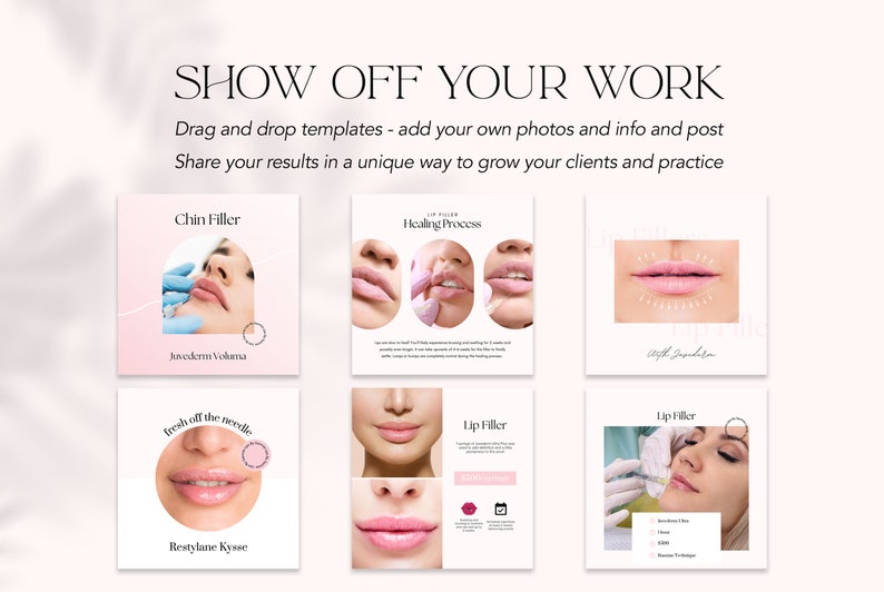 Botox and Filler Instagram Posts Nurse Injector Instagram Etsy