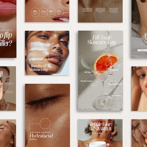 Medspa Social Media, Botox and Filler Instagram Template, Nurse Injector Templates, Skincare Social Media Post, Aesthetic Nurse, Medspa Post