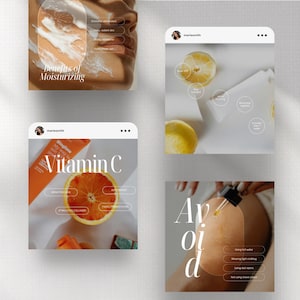 Skincare Instagram Templates, Esthetician Instagram Template, Skincare Social Media Posts, Skincare Bundle, Skincare Coach, Skincare Post