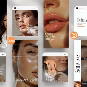 Nurse Injector Instagram Templates, Aesthetic Nurse Template, Medspa Instagram Stories, Medspa Social Media, Botox and Filler Instagram