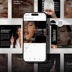 Botox and Filler Instagram Posts, Medspa Templates, Nurse Injector Templates Aesthetic Nurse Posts Medspa Insta Post Medical Aesthetics Post