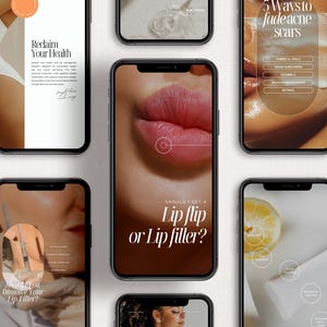 Medspa Instagram, Botox and Filler Social Media, Nurse Injector Templates, Skincare Social Media Post, Aesthetic Nurse, GLP1, Semagluetide