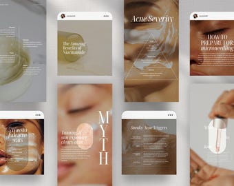 Skincare Instagram Templates, Esthetician Posts, Esthetician Social Media Content, Beauty Template, Skincare Canva Templates