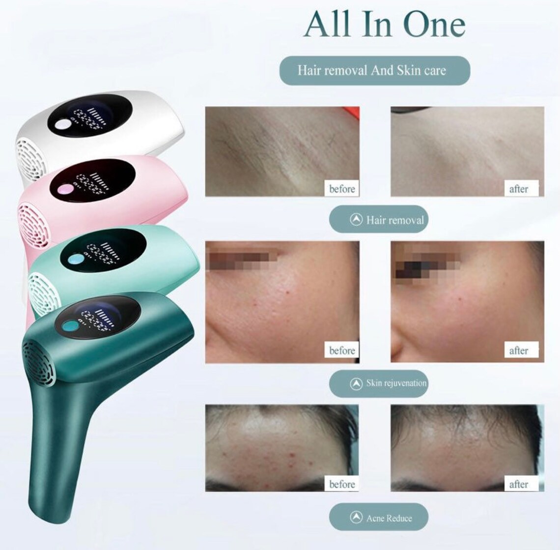 IPL Laser Depilator 999999 flash professional permanent LCD Etsy