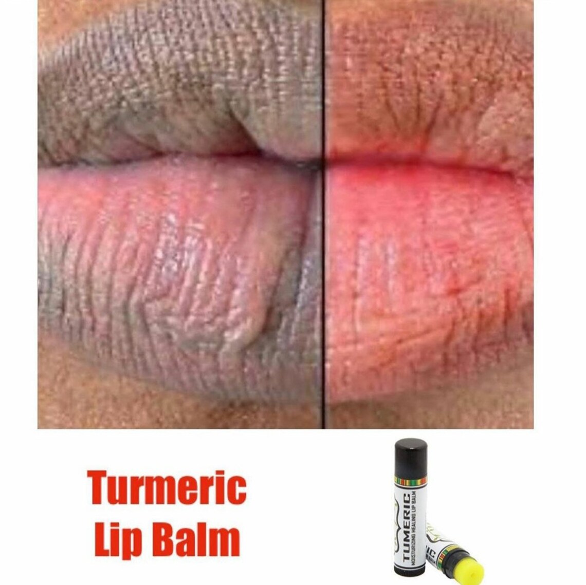 Extreme Naturally Lightening Tumeric Lipbalm Smokers Lips Etsy