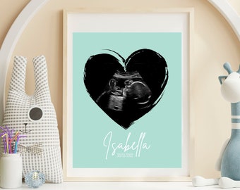 Personalized Baby Ultrasound Print, Mother's Day Gift, Gift for Her, Customized Baby Gift, Baby Shower Gift, Nursery Print, Sonogram File