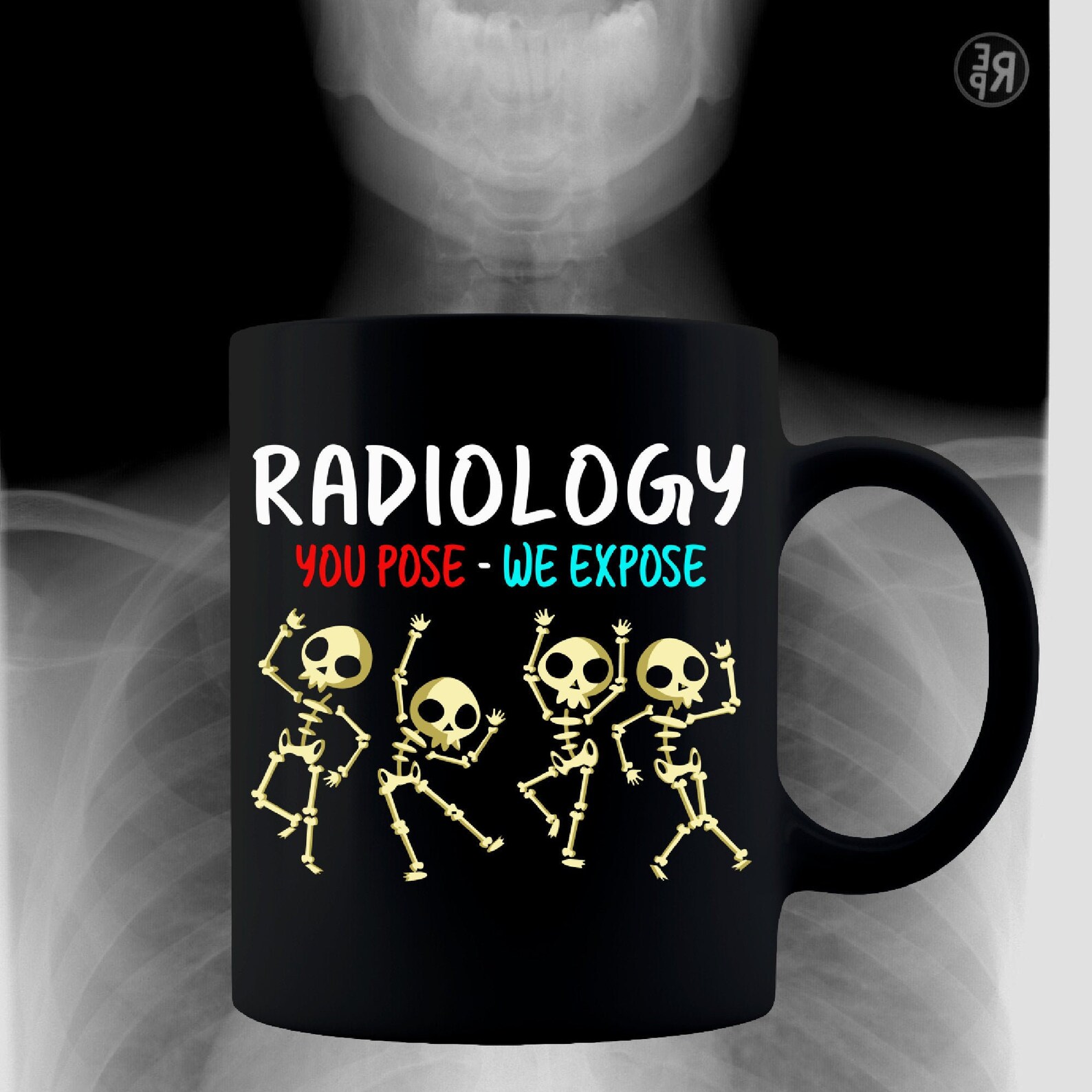 RadiologyYou Pose We Expose Coffee Mug Radiology Week Gift Etsy
