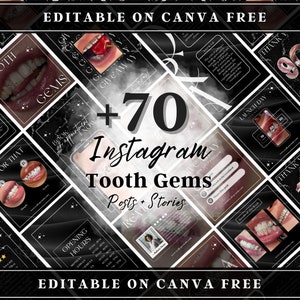 May include: A collage of images promoting tooth gems with the text "+70 Instagram Tooth Gems Posts + Stories" in the centre. The images feature various tooth gem designs, including a close-up of a mouth with a single gem, a phone screen with a countdown timer, and a hand holding a tray of gems.