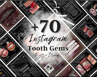 Luxury Tooth Gem Instagram Templates, Editable Black Story Posts (Digital Download)