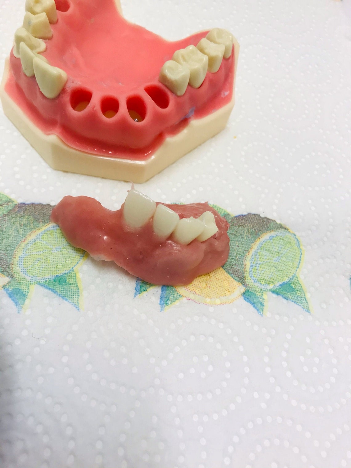 DIY Denture Kit Immediate Partial Denture Upper/Lower ...