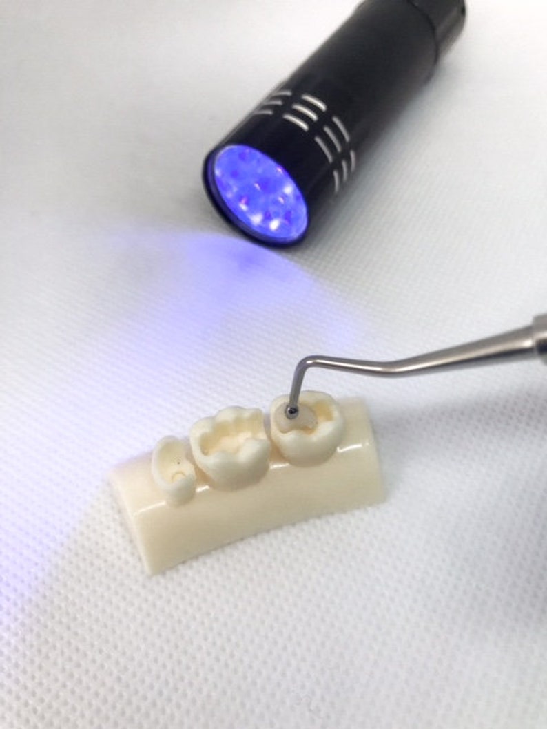 Chipped Tooth Filling Kit DIY Fix Broken Teeth Emergency Etsy