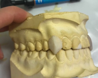 Gör-det-själv-anpassade huggtänder vampyrfasader Grillz Hund-/ögontand Avtagbara huggtänder Fasader Cosplay Anime