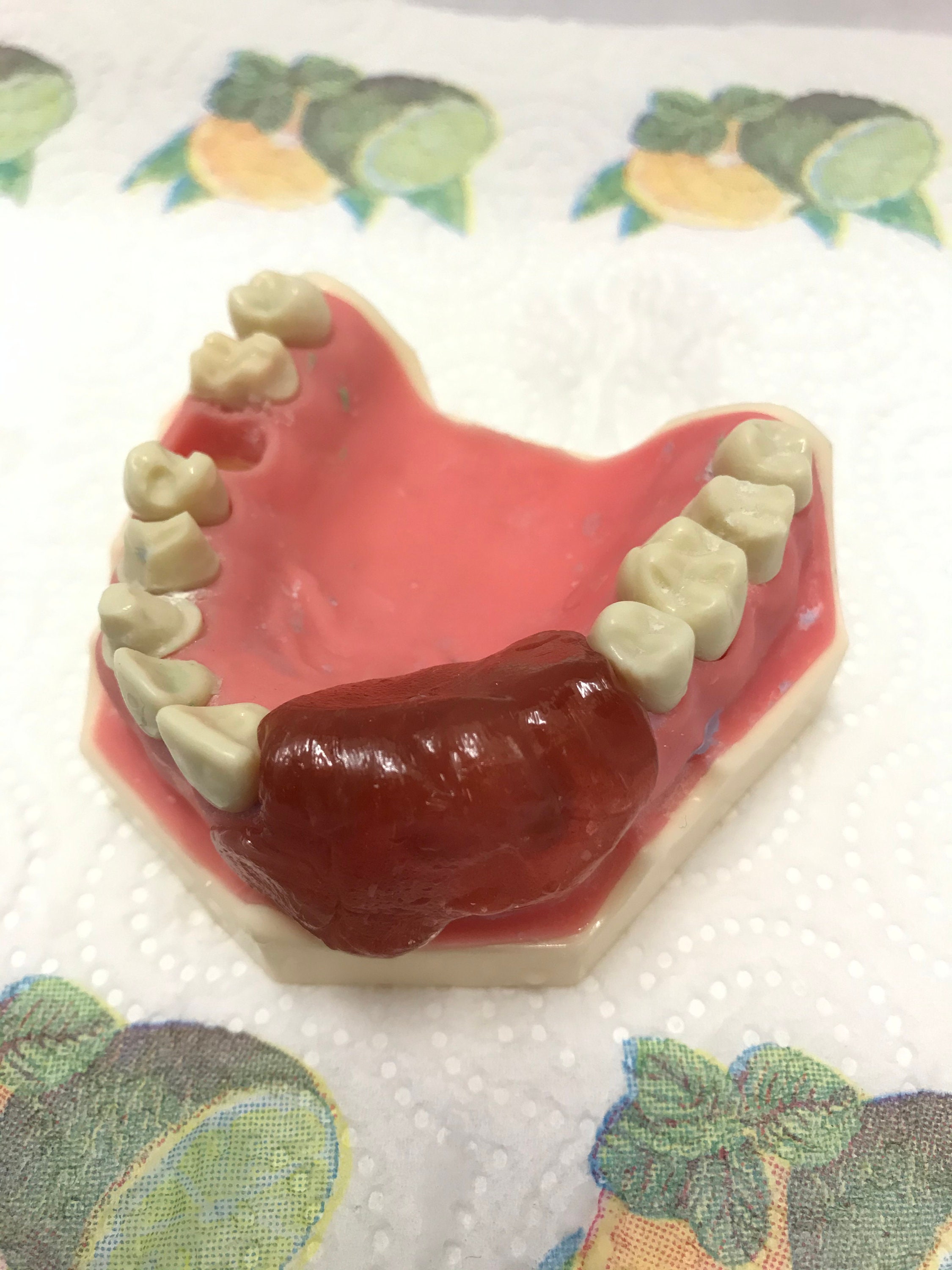 DIY Denture Kit Immediate Partial Denture Upper/Lower Resin Etsy