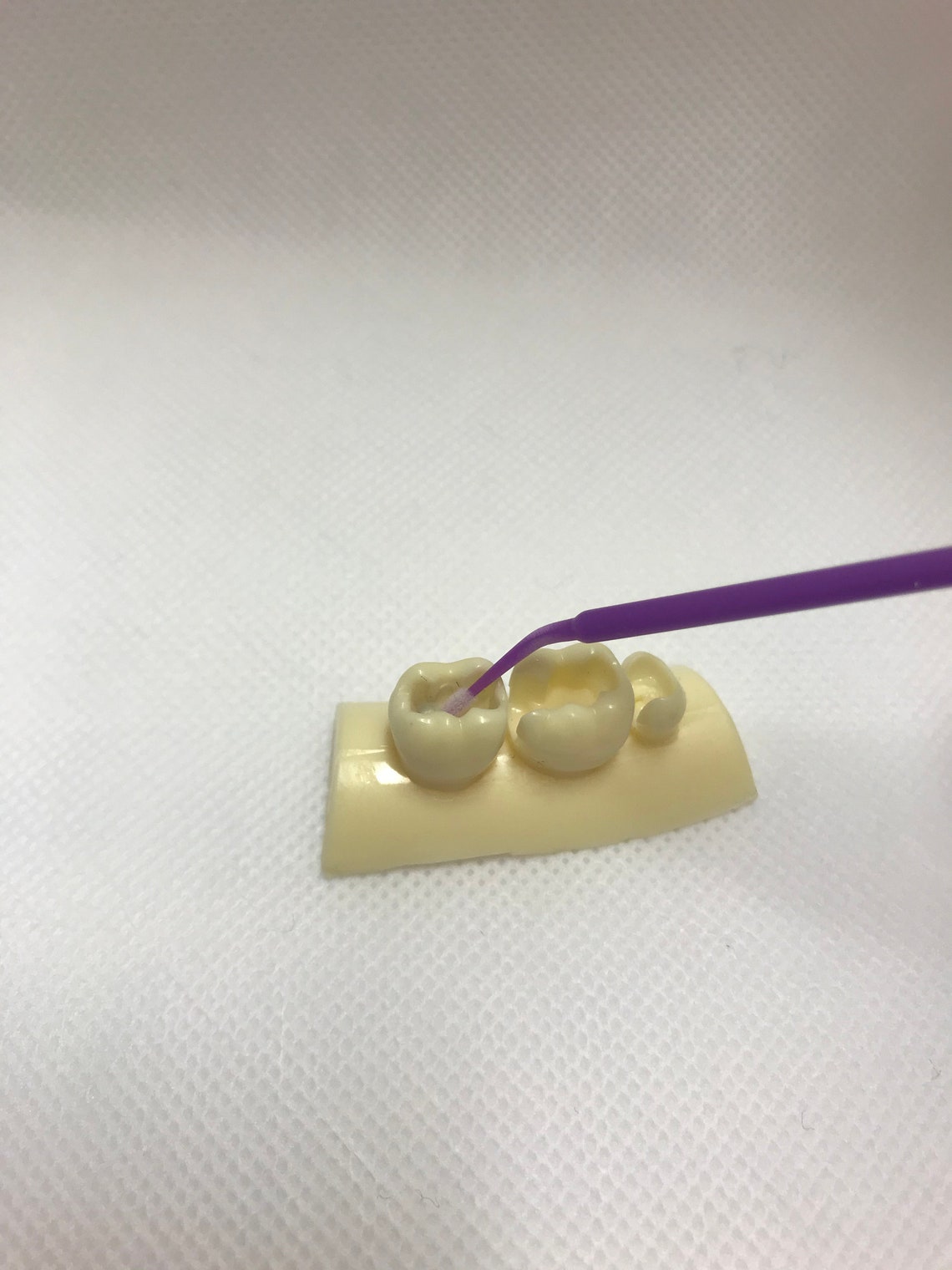 Dental Glue Dental Bond Tooth Filling Glue Loose Crown Glue Etsy