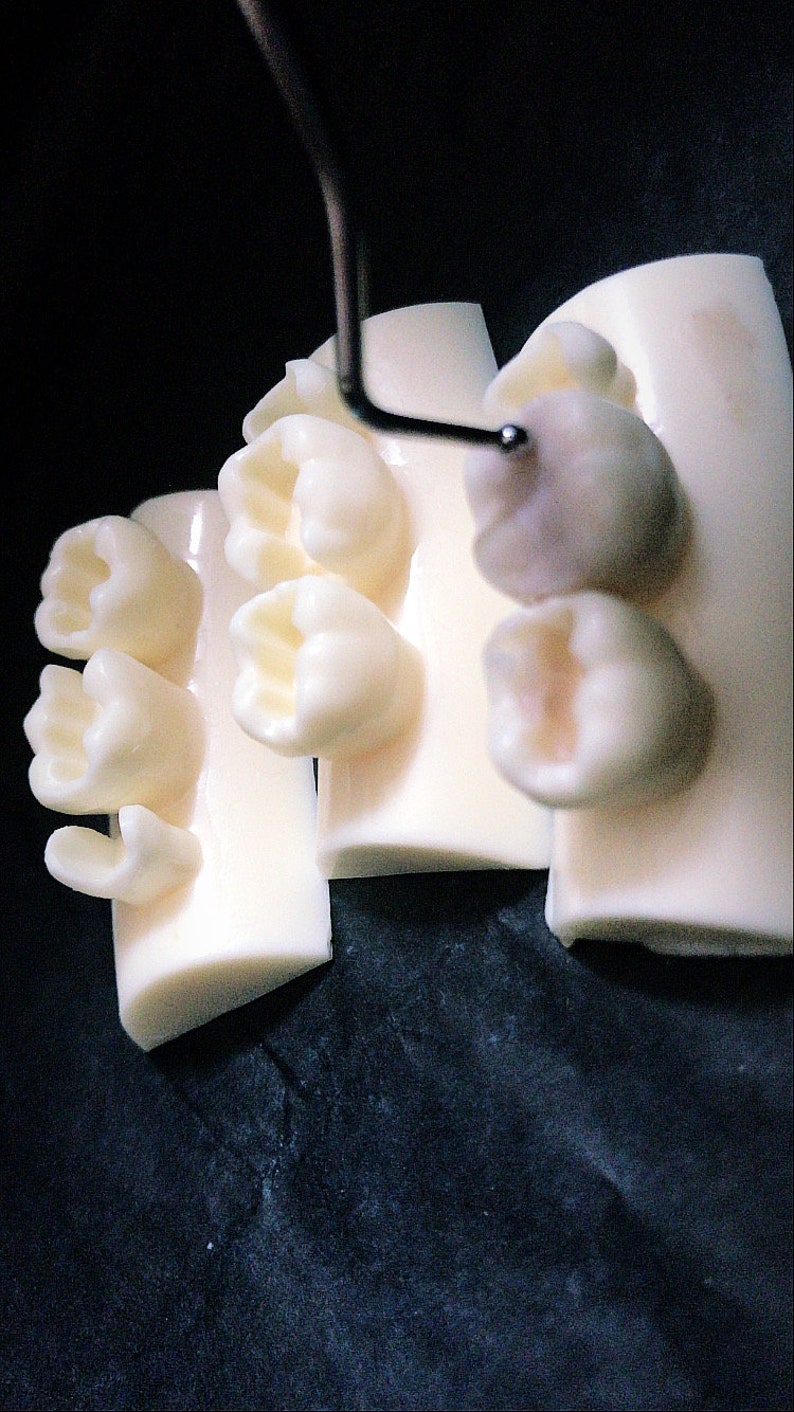 Chipped Tooth Filling Kit DIY Fix Broken Teeth Emergency Etsy