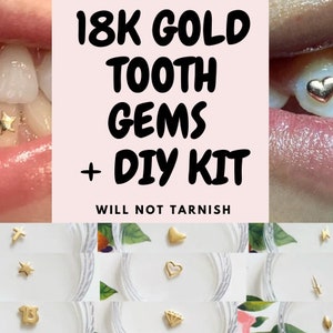 Solid 18K Gold Tooth Gem + DIY Kit, will NOT Tarnish, Professional Application Kit Easy Steps