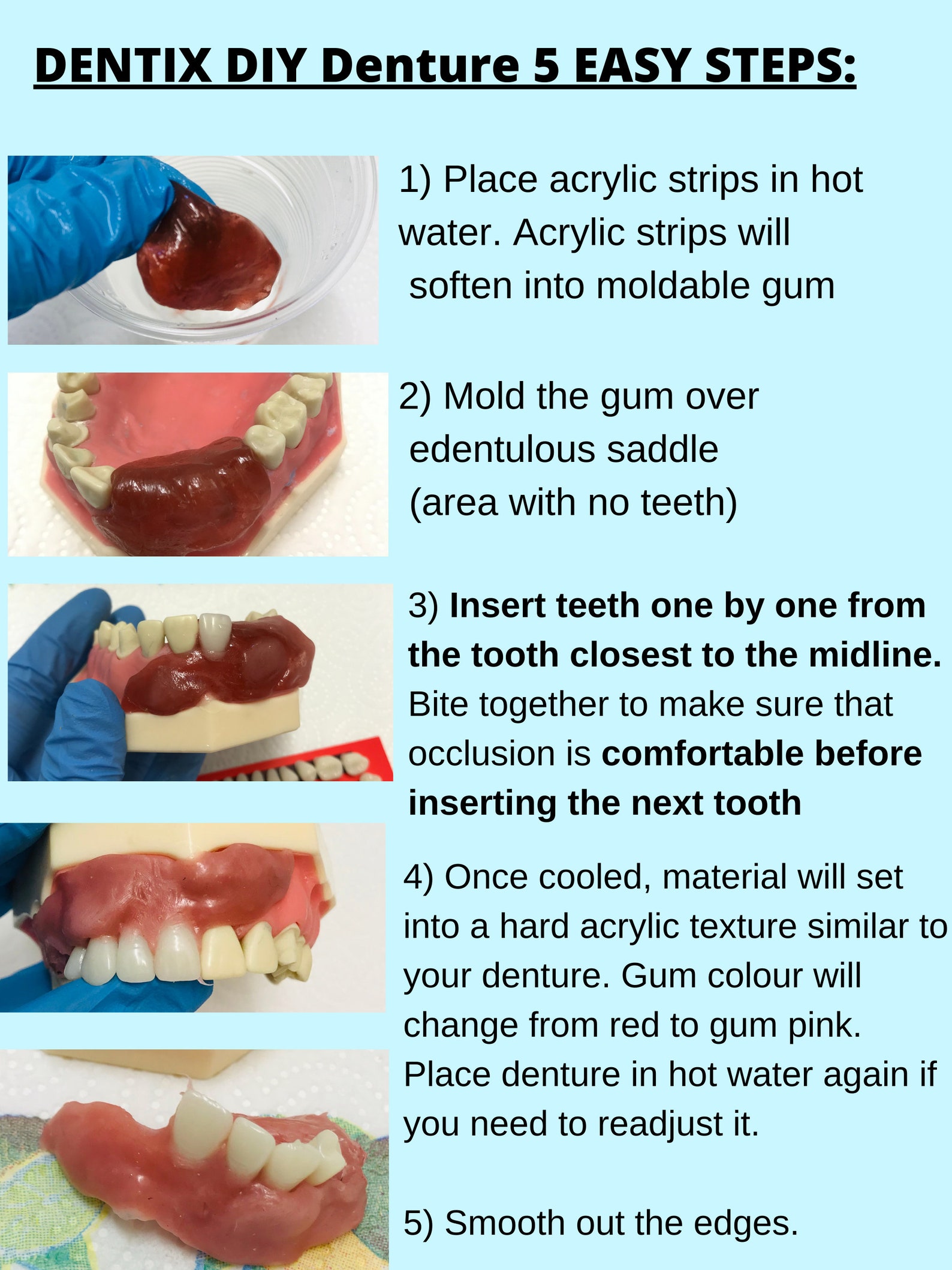 DIY Denture Kit Basic Immediate Partial Denture Full Etsy