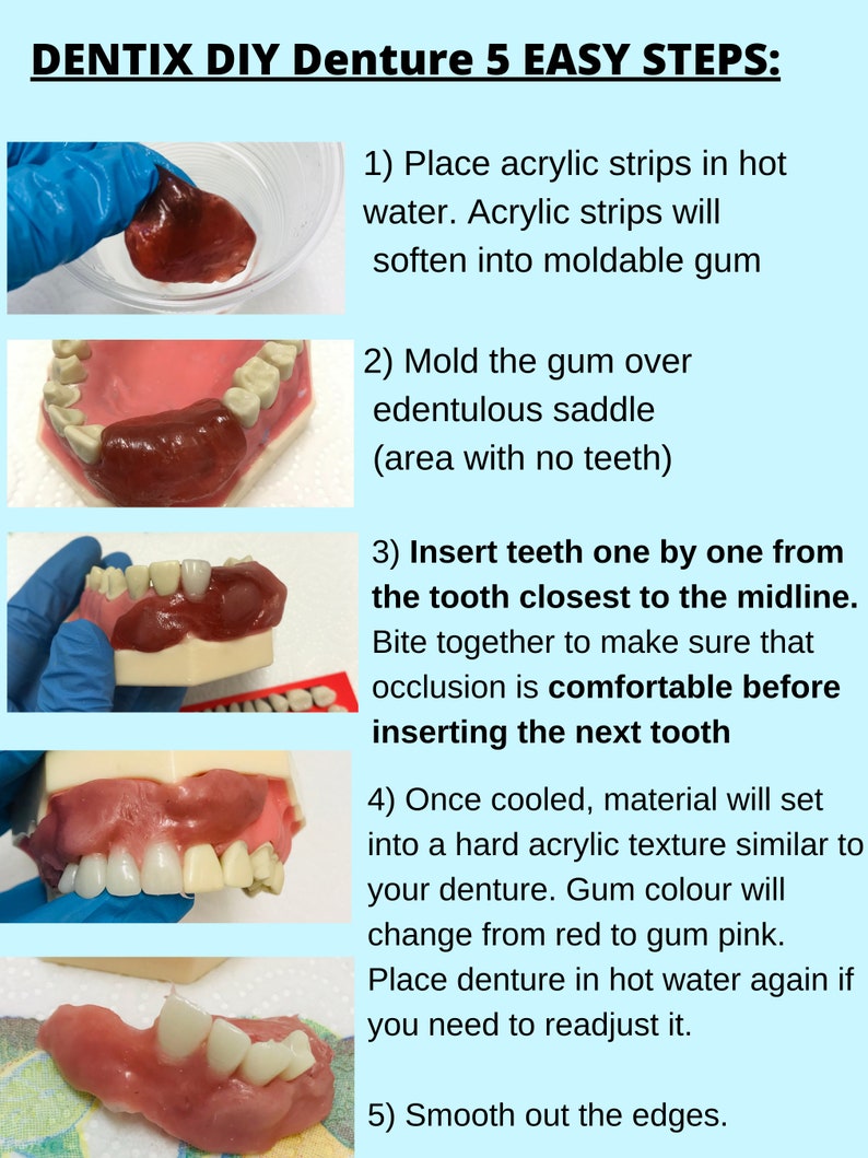 DIY Denture Kit basic Immediate Partial Denture Full Etsy UK