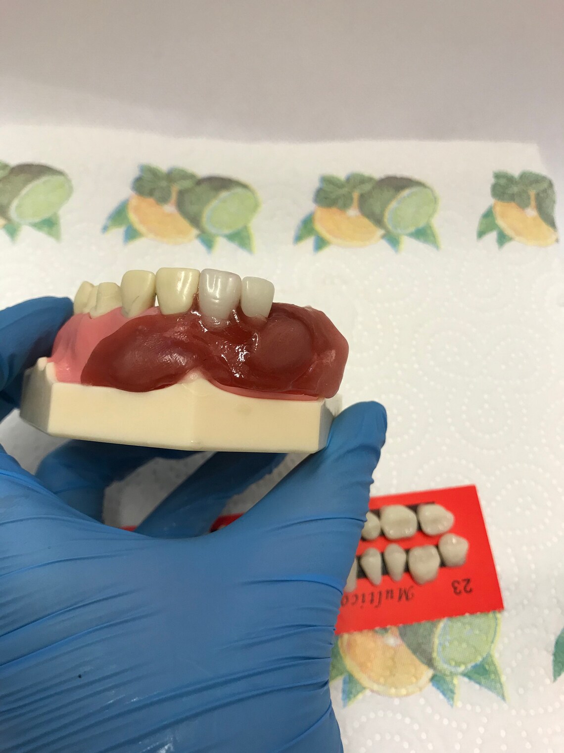 DIY Denture Kit Immediate Partial Denture Upper/Lower Resin Etsy