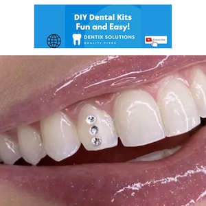 Swarovski Tooth Gem DIY Kit, Professional Grade bonding system used by Dentists