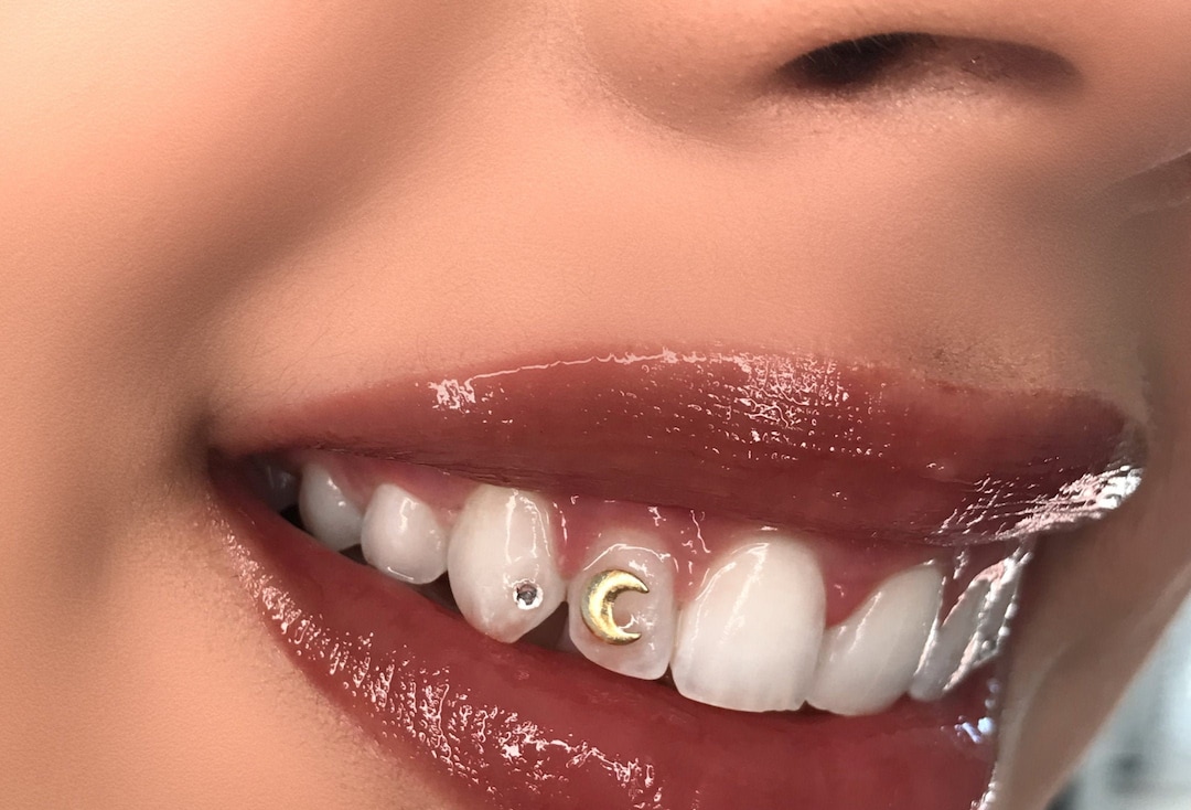 CLASSIC Swarovski Tooth Gem Kit Silver Rhinestones Various Sizes With Dental  Bond Adhesive UV Light Batteries Included, Professional Kit 