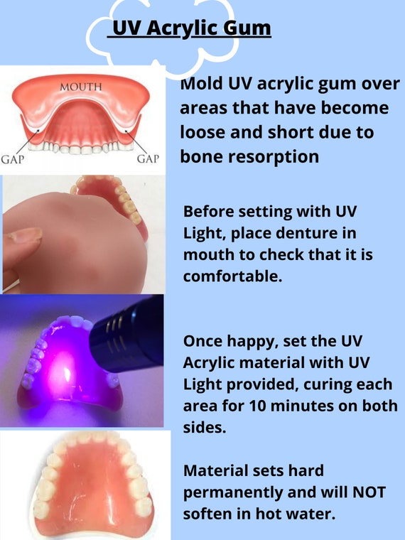 Material de goma para dentaduras postizas, kit de reparación DIY, rebase  para dentaduras postizas, adhesivo para